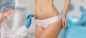 Sculpting Beauty: The Art of Body Contouring in Singapore